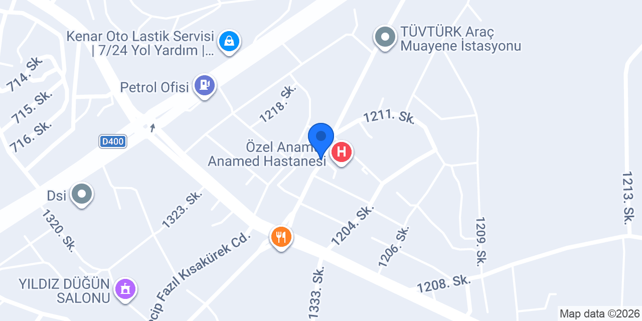 Moda optik konumu