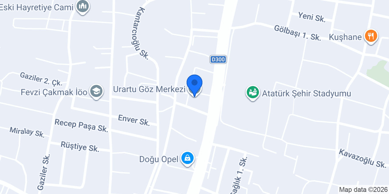 Urartu Göz Merkezi konumu