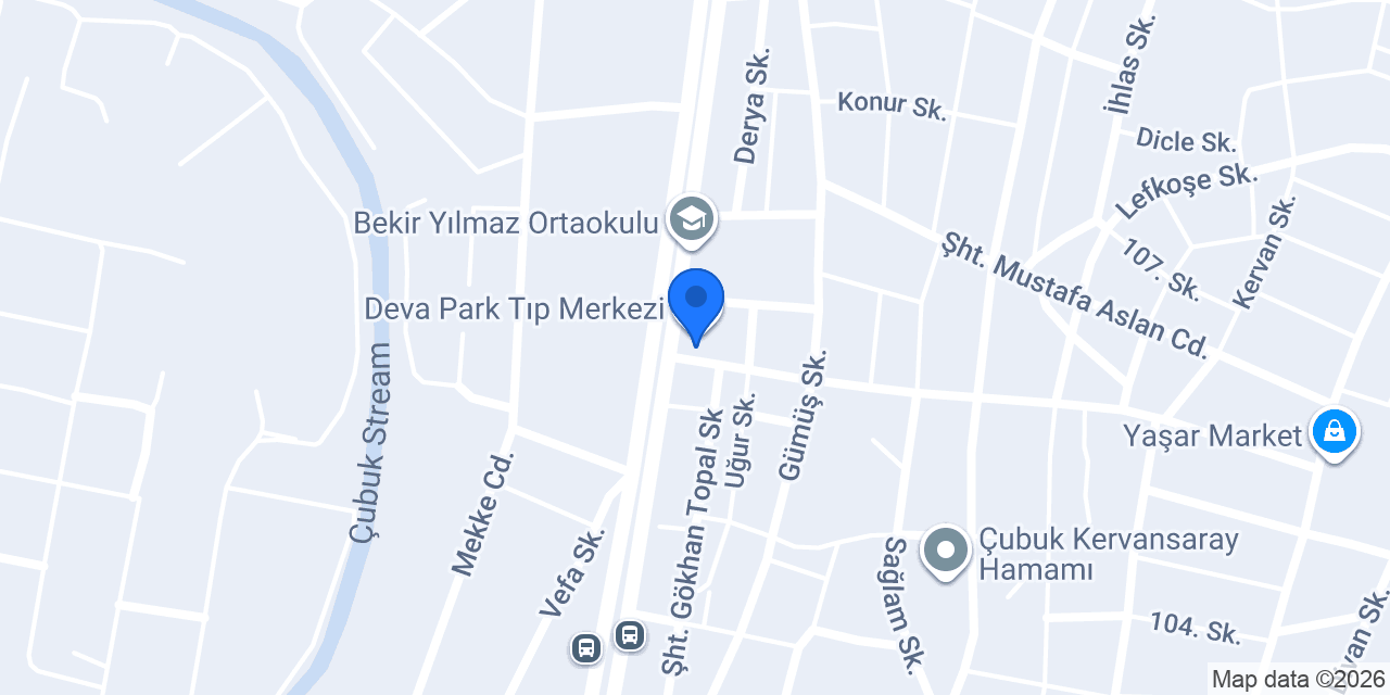 Onat Motor ÇUBUK konumu